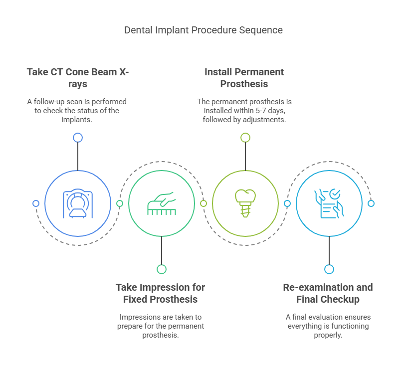All-on-6 Dental Implant Service at Global Dental